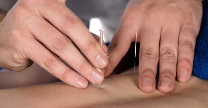 Dry Needling